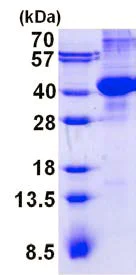 SDS-PAGE - Recombinant Human AMN protein (His tag N-Terminus) (AB139248)