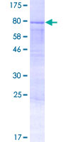 Recombinant Human AMOTL2 protein