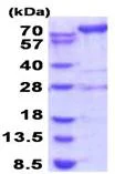 SDS-PAGE - Recombinant Human AMPD2 protein (AB187468)