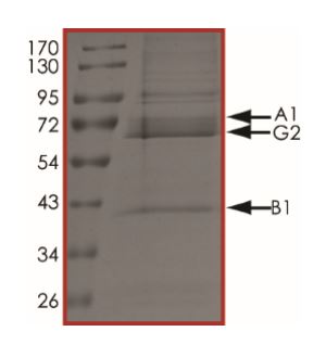 SDS-PAGE - Recombinant human AMPK alpha 1 + AMPK beta 1 + PRKAG2 protein (Active) (AB268333), expandable thumbnail