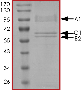 SDS-PAGE - Recombinant human AMPK alpha 1 + AMPK gamma 1 + AMPK beta 2/PRKAB2 protein (Active) (AB268336), expandable thumbnail