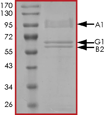 SDS-PAGE - Recombinant human AMPK alpha 1 + AMPK gamma 1 + AMPK beta 2/PRKAB2 protein (Active) (AB268336)