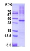 SDS-PAGE - Recombinant Human AMPK alpha 1 protein (AB202156), expandable thumbnail
