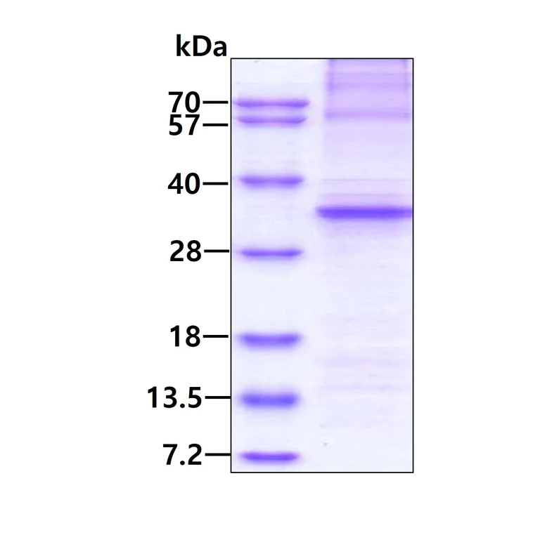 SDS-PAGE - Recombinant Human AMPK alpha 1 protein (AB202156)