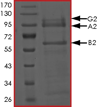 SDS-PAGE - Recombinant human AMPK alpha 2 + AMPK beta 2/PRKAB2 + PRKAG2 protein (Active) (AB268341)