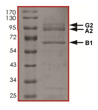 SDS-PAGE - Recombinant human AMPK alpha 2 + beta 1 + gamma 2 protein (AB185258), expandable thumbnail