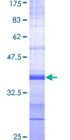 SDS-PAGE - Recombinant Human AMPK alpha 2 protein (GST tag N-Terminus) (AB159189)