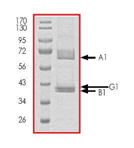 SDS-PAGE - Recombinant human AMPK alpha1 + AMPK beta1 + AMPK gamma1 protein (AB79803)