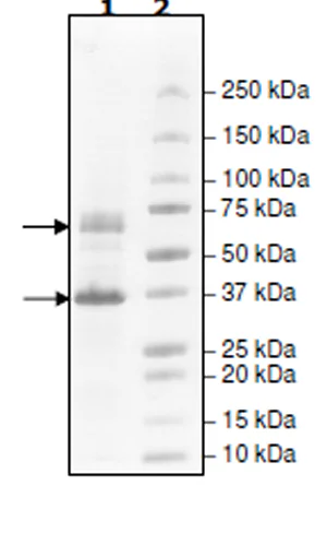 SDS-PAGE - Recombinant human AMPK alpha1 + AMPK beta1 + AMPK gamma1 protein (His tag C-Terminus) (AB271362)
