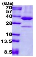 SDS-PAGE - Recombinant Human AMPK beta 2/PRKAB2 protein (denatured) (His tag N-Terminus) (AB137165)