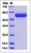 SDS-PAGE - Recombinant Human AMY2B protein (His tag) (AB276562)