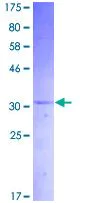 SDS-PAGE - Recombinant Human Amylin/DAP protein (AB132690)