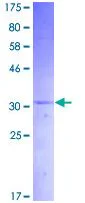 SDS-PAGE - Recombinant Human Amylin/DAP protein (GST tag N-Terminus) (AB132690)