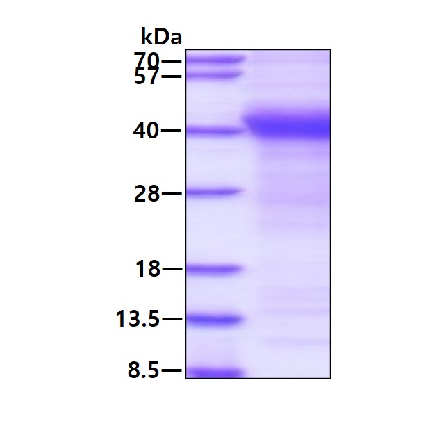 SDS-PAGE - Recombinant Human Amyloid Precursor Protein (His tag N-Terminus) (AB124588)