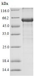 SDS-PAGE - Recombinant Human Androgen Receptor protein (Tagged) (AB235857)