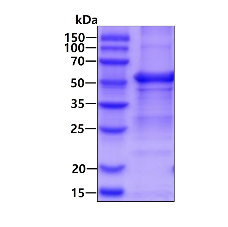 SDS-PAGE - Recombinant Human Angiopoietin 1 protein (denatured) (Tag Free) (AB113163)
