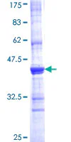 SDS-PAGE - Recombinant Human Angiotensin Converting Enzyme 1 protein (GST tag N-Terminus) (AB158266)