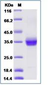 SDS-PAGE - Recombinant Human ANGPTL2/ARP2 protein (His tag) (AB276351)