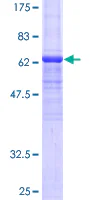 SDS-PAGE - Recombinant Human ANGPTL7 protein (AB160886)