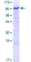 Recombinant Human ANKHD1 protein