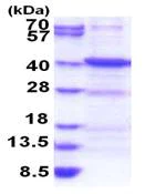 SDS-PAGE - Recombinant Human ANKRA2 protein (His tag N-Terminus) (AB183225)