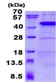 Recombinant Human ANKRD1 protein