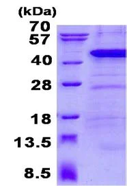 SDS-PAGE - Recombinant Human ANKRD1 protein (AB134543)