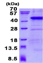 SDS-PAGE - Recombinant Human ANKRD1 protein (His tag N-Terminus) (AB134543)