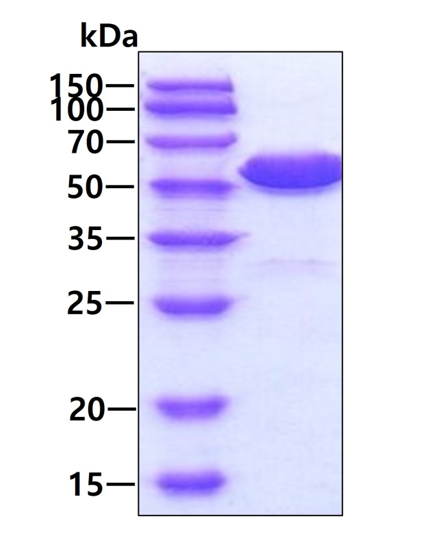 SDS-PAGE - Recombinant Human Annexin-11/ANXA11 protein (His tag N-Terminus) (AB101050)