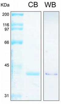 SDS-PAGE - Recombinant Human Annexin-2/ANXA2 protein (AB93005)