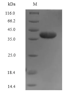SDS-PAGE - Recombinant Human Annexin-2/ANXA2 protein (His tag) (AB267875)