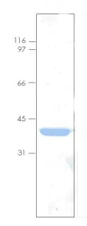 SDS-PAGE - Recombinant Human Annexin-4/ANXA4 protein (AB92815)