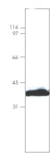 Western blot - Recombinant Human Annexin-4/ANXA4 protein (6x His) (AB92815)