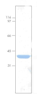 SDS-PAGE - Recombinant Human Annexin-4/ANXA4 protein (AB92815), expandable thumbnail