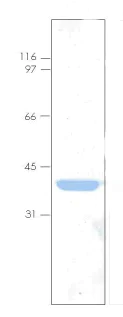 SDS-PAGE - Recombinant Human Annexin-4/ANXA4 protein (AB92815)