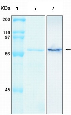 Recombinant Human Annexin-6/ANXA6 protein