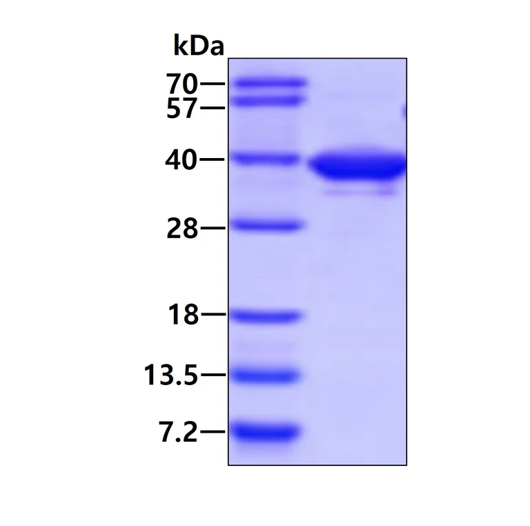 SDS-PAGE - Recombinant Human Annexin A1/ANXA1 protein (AB86446)