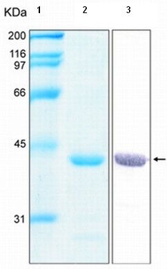Recombinant Human Annexin A1/ANXA1 protein (His tag)