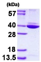 SDS-PAGE - Recombinant Human Annexin A8 like2 protein (His tag N-Terminus) (AB128452)
