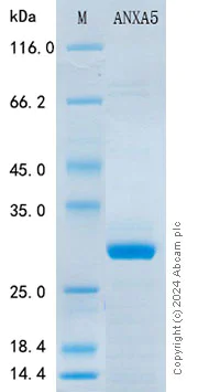 SDS-PAGE - Recombinant Human Annexin V Protein Standard (His tag) (AB316440)