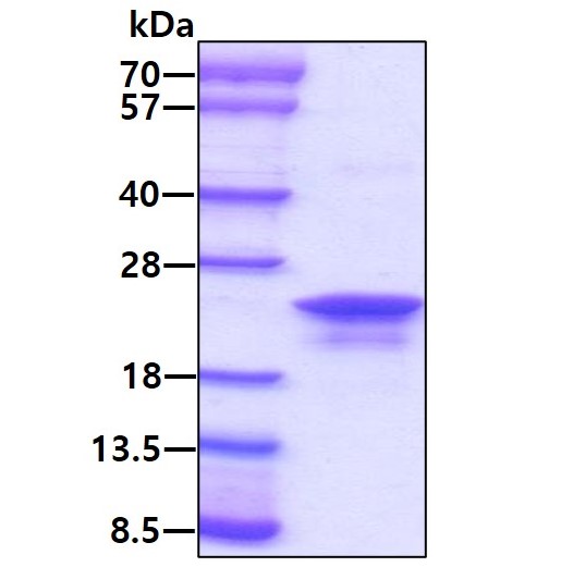 SDS-PAGE - Recombinant Human Anterior Gradient 2 protein (AB64013)