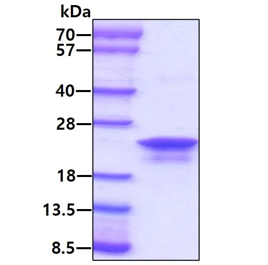 SDS-PAGE - Recombinant Human Anterior Gradient 2 protein (His tag N-Terminus) (AB64013)