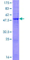 SDS-PAGE - Recombinant Human Antithrombin III/ATIII protein (AB157920)