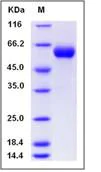 SDS-PAGE - Recombinant Human Antithrombin III/ATIII protein (His tag) (AB276207)
