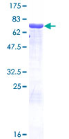 SDS-PAGE - Recombinant Human Antizyme inhibitor 1 protein (AB162598)