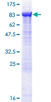 Recombinant Human AP-B protein