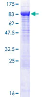 SDS-PAGE - Recombinant Human AP-B protein (AB132648)
