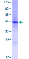 SDS-PAGE - Recombinant Human AP-Q protein (AB165911)