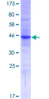 SDS-PAGE - Recombinant Human AP-Q protein (GST tag N-Terminus) (AB165911)