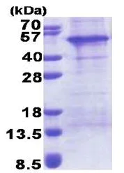 SDS-PAGE - Recombinant Human AP1AR/Gadkin protein (His tag N-Terminus) (AB171698)
